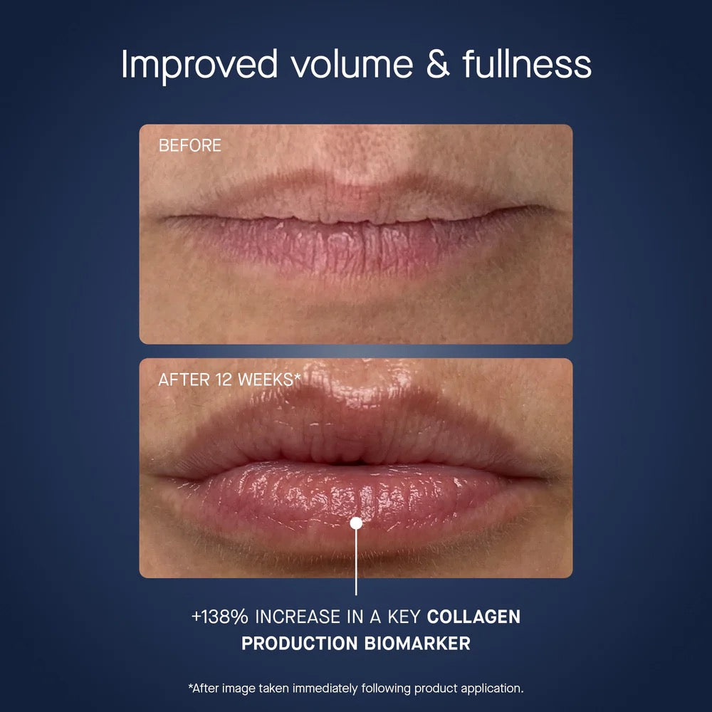 OS-01 Lip Restore Mask